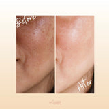 Lightex Whitening Tablets Lightex Whitening Tablets